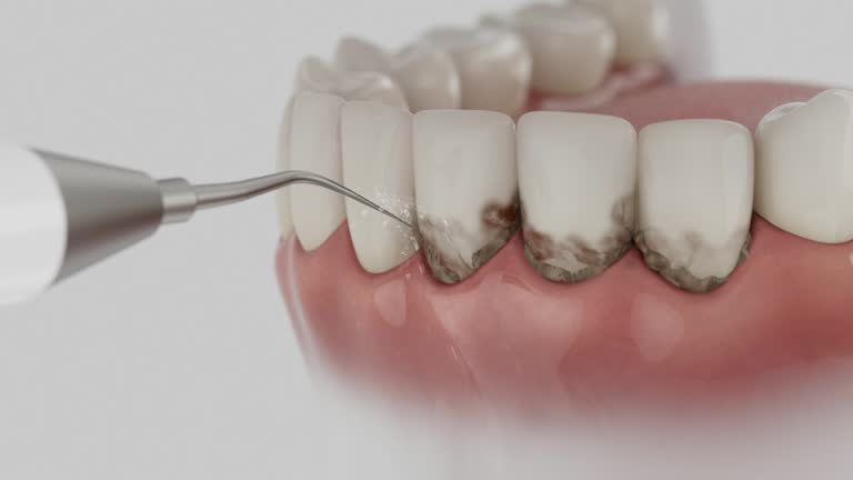 Trusted Teeth Cleaning And Checkup service in Fulton, MS - Dentist Open Now